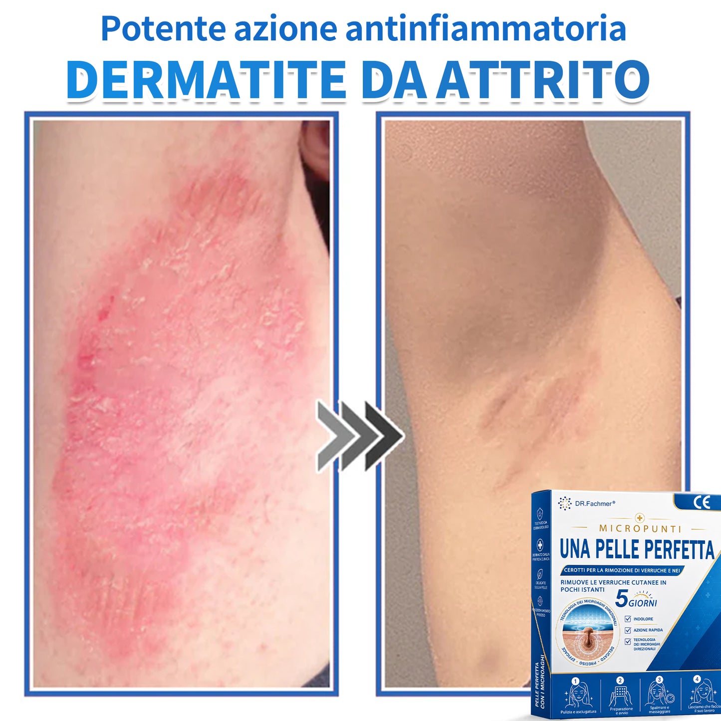 ✅ DR.Fachmen® Cerotto 2-in-1 con Microaghi e Idrocolloide | Per Brufoli, Verruche Piane ed Escrescenze Cutanee | Aiuta a Ridurre Rughe, Cicatrici e Imperfezioni | Invisibile su Viso e Corpo
