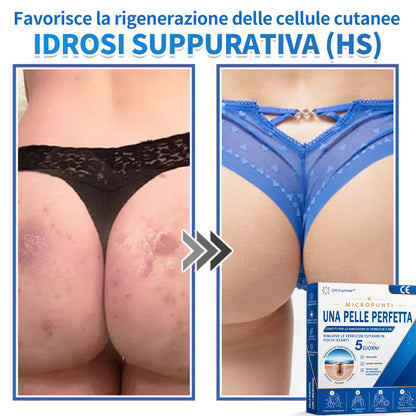 ✅ DR.Fachmen® Cerotto 2-in-1 con Microaghi e Idrocolloide | Per Brufoli, Verruche Piane ed Escrescenze Cutanee | Aiuta a Ridurre Rughe, Cicatrici e Imperfezioni | Invisibile su Viso e Corpo