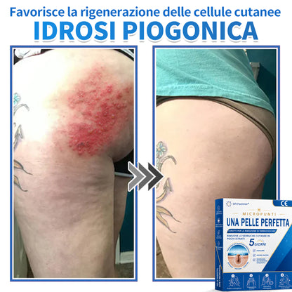 ✅ DR.Fachmen® Cerotto 2-in-1 con Microaghi e Idrocolloide | Per Brufoli, Verruche Piane ed Escrescenze Cutanee | Aiuta a Ridurre Rughe, Cicatrici e Imperfezioni | Invisibile su Viso e Corpo