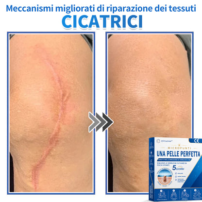 ✅ DR.Fachmen® Cerotto 2-in-1 con Microaghi e Idrocolloide | Per Brufoli, Verruche Piane ed Escrescenze Cutanee | Aiuta a Ridurre Rughe, Cicatrici e Imperfezioni | Invisibile su Viso e Corpo