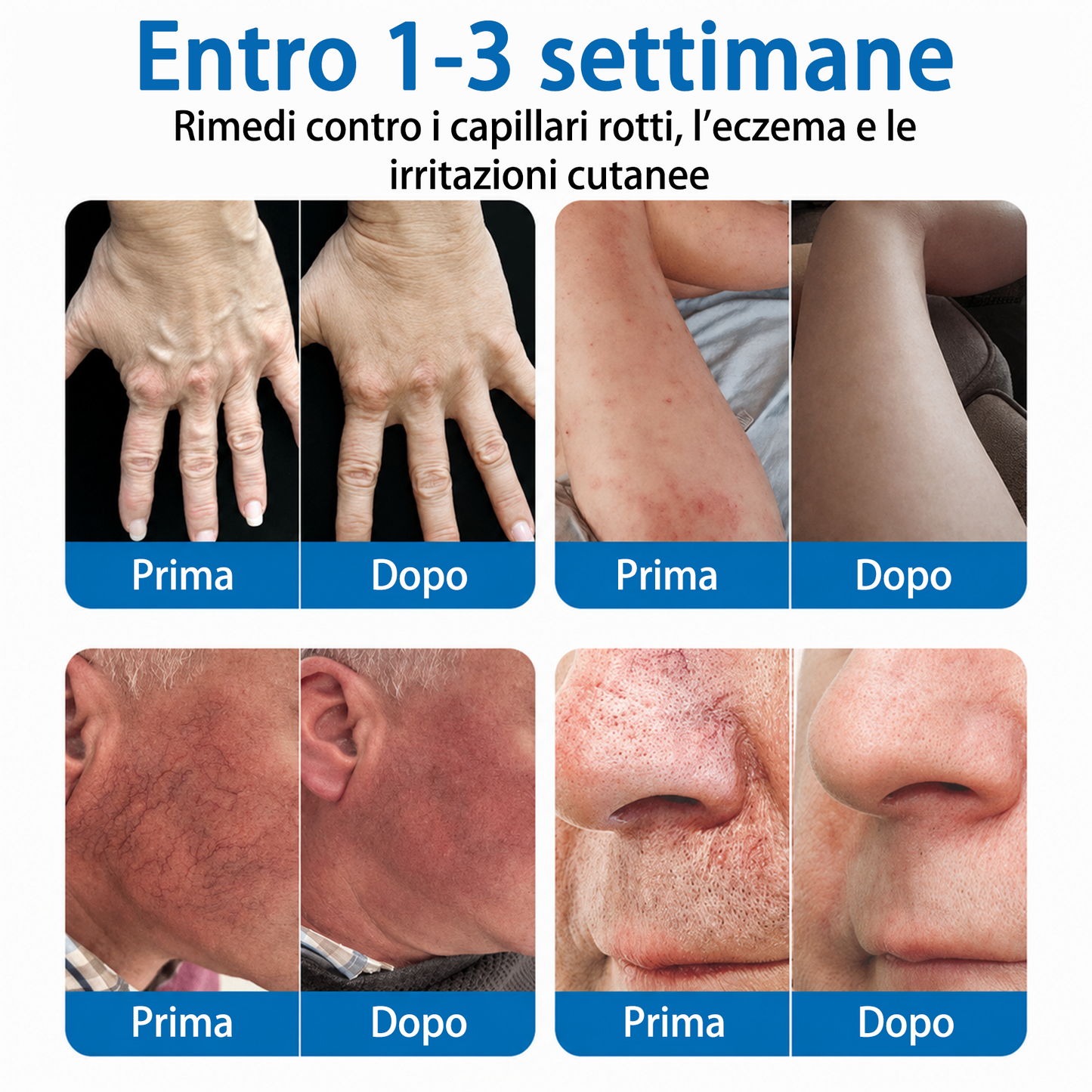 👨‍⚕️✅🧡GFOUK® Cerotto ai Microaghi VeinRepair⚡Sollievo Immediato, Risultati a Lungo Termine
