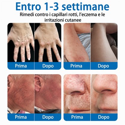 👨‍⚕️✅🧡GFOUK® Cerotto ai Microaghi VeinRepair⚡Sollievo Immediato, Risultati a Lungo Termine