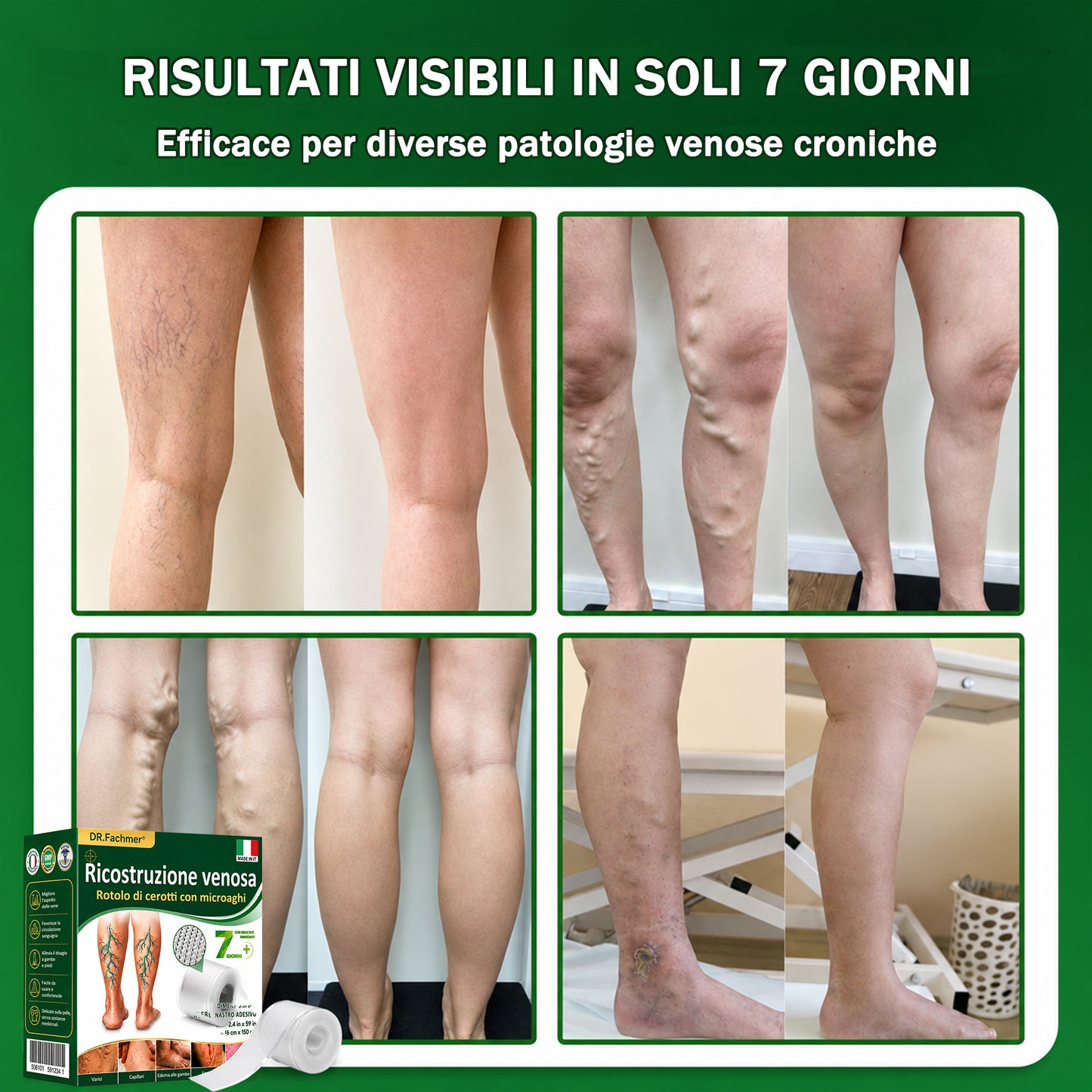 👨‍⚕️✅❤️DR.Fachmer® Cerotto ai Microaghi VeinRepair⚡Sollievo Immediato, Risultati a Lungo Termine