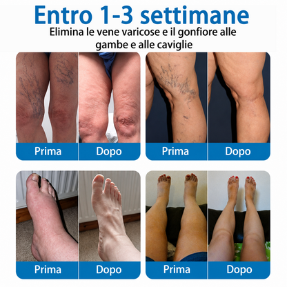 👨‍⚕️✅🧡GFOUK® Cerotto ai Microaghi VeinRepair⚡Sollievo Immediato, Risultati a Lungo Termine