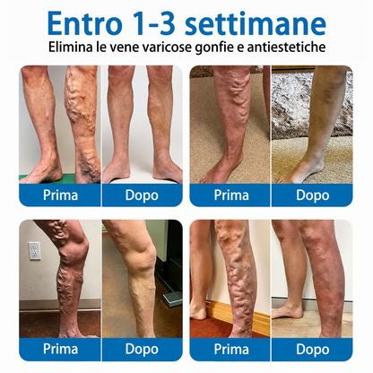 👨‍⚕️✅🧡GFOUK® Cerotto ai Microaghi VeinRepair⚡Sollievo Immediato, Risultati a Lungo Termine