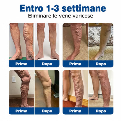 🇮🇹✅𝗚𝗙𝗢𝗨𝗞® 𝗩𝗲𝗶𝗻𝗧𝗮𝗿𝗴𝗲𝘁 𝗠𝗶𝗰𝗿𝗼𝗻𝗲𝗲𝗱𝗹𝗲 𝗣𝗮𝘁𝗰𝗵⚡𝗦𝗼𝗹𝗹𝗶𝗲𝘃𝗼 𝗶𝗺𝗺𝗲𝗱𝗶𝗮𝘁𝗼, 𝗿𝗶𝘀𝘂𝗹𝘁𝗮𝘁𝗶 𝗮 𝗹𝘂𝗻𝗴𝗼 𝘁𝗲𝗿𝗺𝗶𝗻𝗲