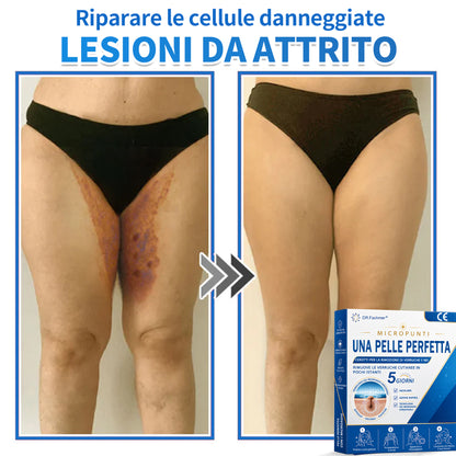 ✅ DR.Fachmen® Cerotto 2-in-1 con Microaghi e Idrocolloide | Per Brufoli, Verruche Piane ed Escrescenze Cutanee | Aiuta a Ridurre Rughe, Cicatrici e Imperfezioni | Invisibile su Viso e Corpo