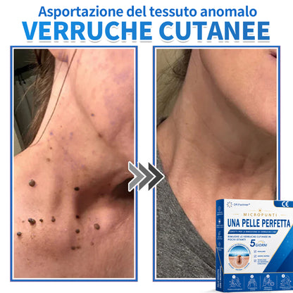 ✅ DR.Fachmen® Cerotto 2-in-1 con Microaghi e Idrocolloide | Per Brufoli, Verruche Piane ed Escrescenze Cutanee | Aiuta a Ridurre Rughe, Cicatrici e Imperfezioni | Invisibile su Viso e Corpo