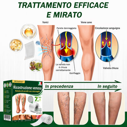 👨‍⚕️✅❤️DR.Fachmer® Cerotto ai Microaghi VeinRepair⚡Sollievo Immediato, Risultati a Lungo Termine